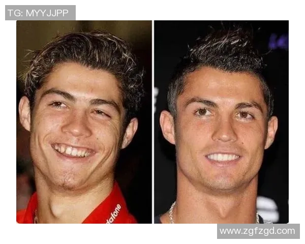 足球明星整容真相揭秘及前后对比图片大曝光 足球明星整容真相揭秘及前后对比图片大曝光